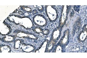 IHC analysis of ASS1 using anti-ASS1 antibody (ABIN7601192).