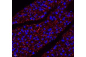 Immunofluorescence of paraffin embedded mouse pancreas using Aldh4a1 (ABIN7073000) at dilution of 1: 400 (400x lens)