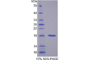 Image no. 1 for Prefoldin Subunit 1 (PFDN1) (AA 1-122) protein (His tag) (ABIN4989492)