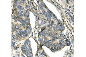 IHC analysis of ATP5H using anti-ATP5H antibody (ABIN7600467).