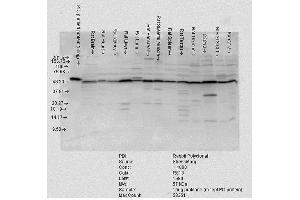 Western blot analysis of Rat tissue mix showing detection of PDI protein using Rabbit Anti-PDI Polyclonal Antibody . (P4HB anticorps  (AA 409-509) (PE))