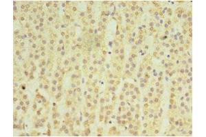 Immunohistochemistry of paraffin-embedded human adrenal gland tissue using ABIN7159049 at dilution of 1:100 (Matrilin 3 anticorps  (AA 277-486))