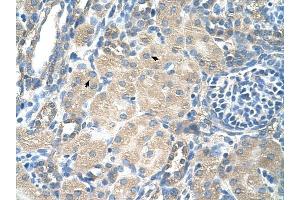 SLC13A3 antibody was used for immunohistochemistry at a concentration of 4-8 ug/ml to stain Epithelial cells of renal tubule (arrows) in Human Kidney.