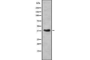 Western blot analysis of RNLS using A549 whole cell lysates (RNLS anticorps  (C-Term))