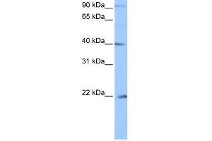 WB Suggested Anti-C4orf33 Antibody Titration: 0. (C4orf33 anticorps  (C-Term))