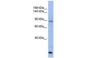 Image no. 1 for anti-Unc-45 Homolog A (UNC45A) (C-Term) antibody (ABIN6744028) (UNC45A anticorps  (C-Term))