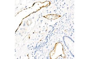 Immunohistochemistry of paraffin-embedded Human colon using von Willebrand factor (VWF) antibody (ABIN7271339) at dilution of 1:800 (40x lens). (VWF anticorps)