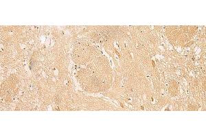 Immunohistochemistry of paraffin-embedded Human brain tissue using MGST3 Polyclonal Antibody at dilution of 1:30(x200) (MGST3 anticorps)