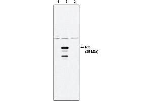 Western Blotting (WB) image for anti-Ras-Like Without CAAX 1 (RIT1) antibody (ABIN264412) (RIT1 anticorps)