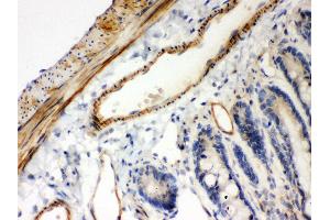 Anti- IKB beta Picoband antibody,IHC(P) IHC(P): Rat Intestine Tissue