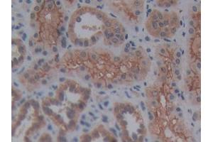DAB staining on IHC-P; Samples: Human Kidney Tissue