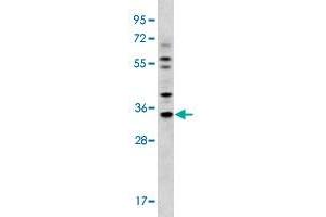 Western blot analysis of MDA-MB-231 cell lysate (35 ug/lane) with GJB5 polyclonal antibody .