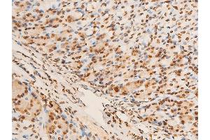 ABIN6267301 at 1/100 staining mouse gastric tissue sections by IHC-P.