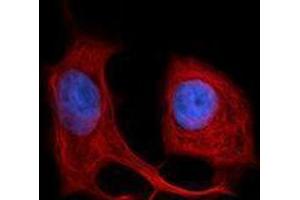 Immunofluorescence (IF) image for anti-Keratin 18 (KRT18) antibody (Alexa Fluor 594) (ABIN2656840) (Cytokeratin 18 anticorps  (Alexa Fluor 594))