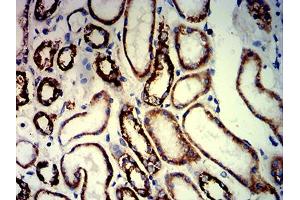 Immunohistochemical analysis of paraffin-embedded kidney tissues using PAX8 mouse mAb with DAB staining.