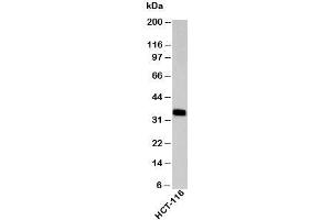 Western blot testing of human samples with EpCAM antibody at 2ug/ml. (EpCAM anticorps  (C-Term))