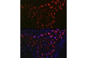 Immunofluorescence analysis of Mouse cartilage using MGP Rabbit pAb (ABIN6128268, ABIN6143825, ABIN6143826 and ABIN6221090) at dilution of 1:100 (40x lens).