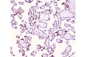 IHC analysis of LRTOMT using anti-LRTOMT antibody (ABIN7602986). (Leucine Rich Transmembrane and 0-Methyltransferase Domain Containing (LRTOMT) (Middle Region) anticorps)