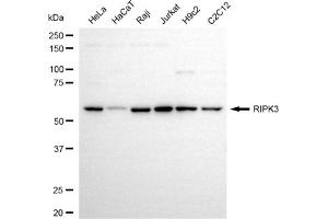 Western blotting analysis using RIPK3 antibody (ABIN7800160).