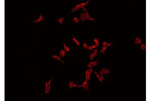ABIN6266870 staining Hela by IF/ICC. (MAST2 anticorps  (Internal Region))
