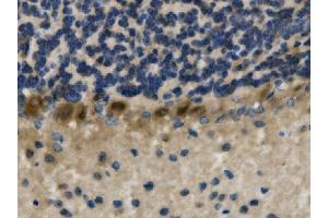 IHC analysis of LHX1 using anti-LHX1 antibody (ABIN7599263). (LHX1 anticorps  (AA 1-317))