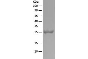 Western Blotting (WB) image for tau Protein (AA 200-380) protein (His tag) (ABIN7125322)