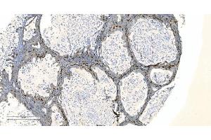 IHC analysis of Coronin 1a/TACO/CORO1A using anti-Coronin 1a/TACO/CORO1A antibody (ABIN7600292).