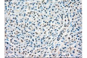 Immunohistochemistry (IHC) image for anti-RAD9 Homolog A (S. Pombe) (RAD9A) antibody (ABIN1500581)