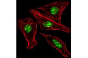Immunofluorescent analysis of 4 % paraformaldehyde-fixed, 0.