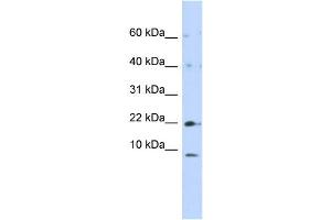 WB Suggested Anti-NDUFC2 Antibody Titration:  0.