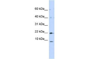 WB Suggested Anti-NDUFC2 Antibody Titration:  0.