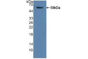 Figure. (ALDH1A1 anticorps  (AA 2-501))
