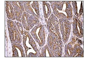IHC analysis of HCCS using anti-HCCS antibody (ABIN7602424). (HCCS anticorps  (AA 76-268))