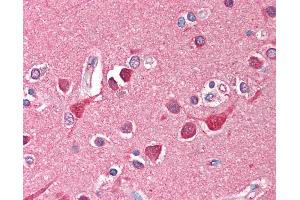Anti-TF / Transferrin antibody IHC of human brain, cortex. (Transferrin anticorps)