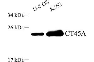 Western blot analysis of CT45A (ABIN7073596),at dilution of 1: 1500 (CT45A10 anticorps)