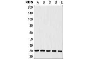 Western blot analysis of MRPL28 expression in JAR (A), MCF7 (B), A549 (C), Raw264.
