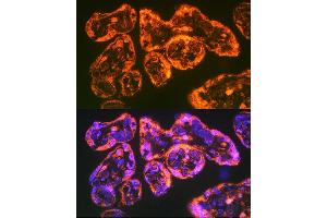 anti-Integrin, alpha 5 (ITGA5) (AA 750-1000) antibody
