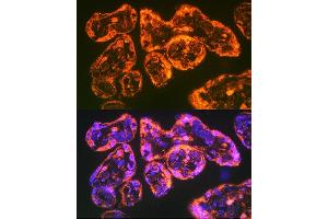 Immunofluorescence analysis of Human placenta using Integrin alpha 5 (ITG/CD49e) antibody (ABIN6131552, ABIN6142564, ABIN6142565 and ABIN6221799) at dilution of 1:100. (ITGA5 anticorps  (AA 750-1000))