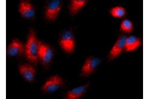 Immunofluorescence (IF) image for anti-Tetraspanin 26 (TSPAN26) (AA 112-241) antibody (PE) (ABIN5566698) (CD37 anticorps  (AA 112-241) (PE))