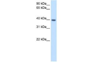 WB Suggested Anti-ITGB1BP2 Antibody Titration:  2. (ITGB1BP2 anticorps  (N-Term))