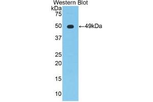 Detection of Recombinant NSE, Mouse using Polyclonal Antibody to Enolase, Neuron Specific (NSE)