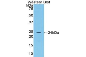Western Blotting (WB) image for anti-Angiopoietin 1 (ANGPT1) (AA 35-231) antibody (ABIN1857990) (Angiopoietin 1 anticorps  (AA 35-231))
