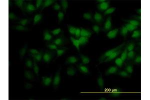 Immunofluorescence of monoclonal antibody to SCAND2 on HeLa cell. (SCAND2 anticorps  (AA 1-62))