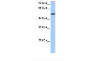 Image no. 1 for anti-Cytochrome P450, Family 1, Subfamily B, Polypeptide 1 (CYP1B1) (AA 200-249) antibody (ABIN6738781)