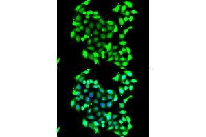 Immunofluorescence analysis of A549 cell using GTF2H3 antibody. (GTF2H3 anticorps)