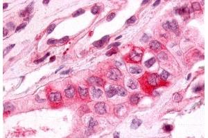 Anti-PTGER3 / EP3 antibody  ABIN1049256 IHC staining of human kidney, renal tubules.