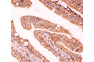 IHC(P) staining of mouse intestine tissue (NFKB2 anticorps  (AA 1-340))