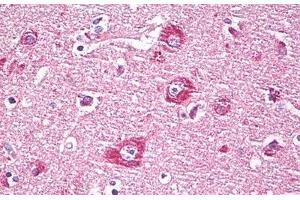 Anti-DACT1 / DAPPER antibody IHC staining of human brain, cortex neurons.