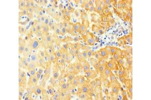 Immunohistochemistry of paraffin-embedded human liver tissue using ABIN7153912 at dilution of 1:100 (G6PC anticorps  (AA 82-117))