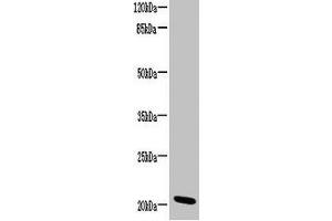 Western blot All lanes: CCDC32 antibody at 2 μg/mL + HL60 whole cell lysate Secondary Goat polyclonal to rabbit IgG at 1/10000 dilution Predicted band size: 21, 22, 16 kDa Observed band size: 21 kDa (C15ORF57 anticorps  (AA 1-185))